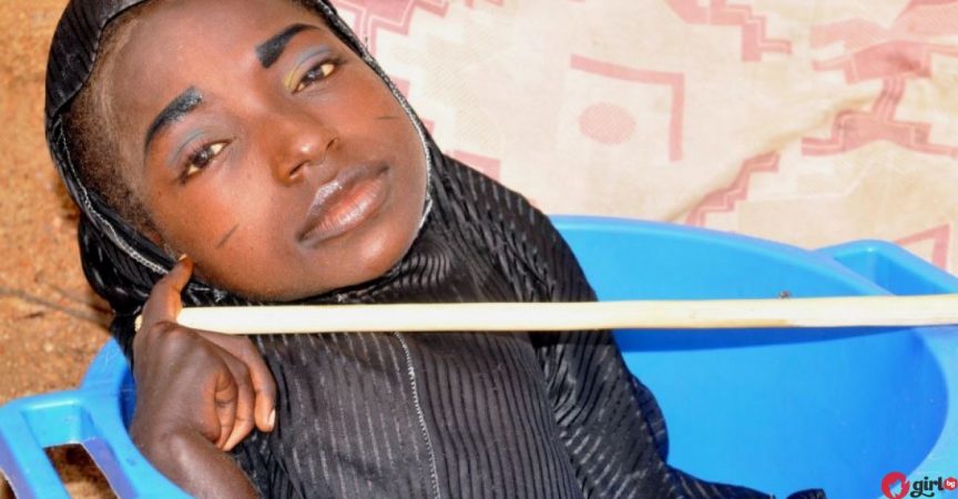 Момичето, което живее в леген: Историята, която ще ви остави без думи и ще ви накара да оцените живота си! Момичето, което живее в леген: Историята, която ще ви остави без думи и ще ви накара да оцените живота си!