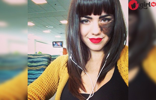 Като малка ѝ се подиграваха заради косматия белег и я караха да го премахне, но тя запуши устите на всички! Като малка ѝ се подиграваха заради косматия белег и я караха да го премахне, но тя запуши устите на всички!