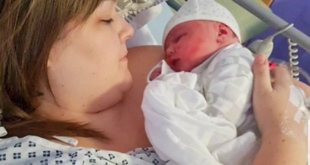 Жена раждаше секцио и в първия момент, когато извадиха бебето тя реши че ражда извънземно [СНИМКИ]